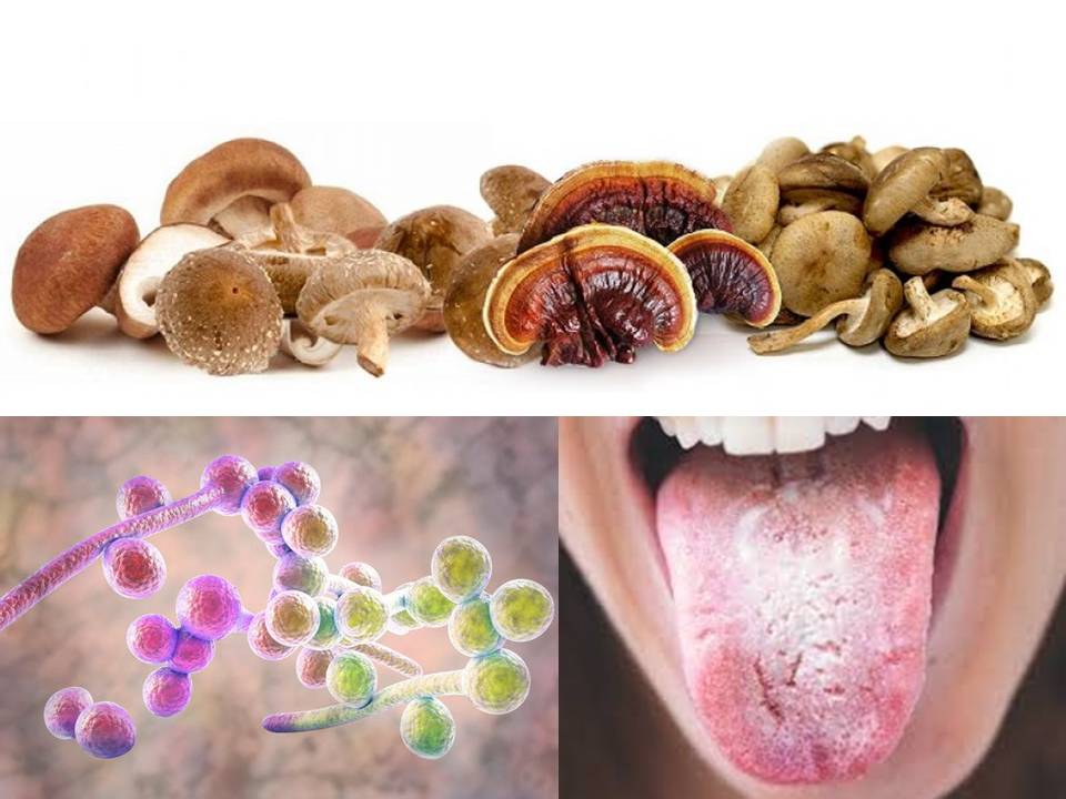 FUNGHI MEDICINALI E ALTRI RIMEDI CONTRO LA CANDIDA ALBICANS (E ALTRE SPECIE DI CANDIDA)