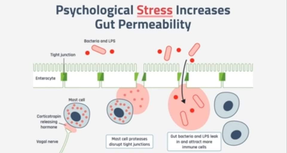 LO STRESS CAUSA DI PERMEABILITÀ INTESTINALE E MALATTIE (CARDIACHE E NEUROLOGICHE)